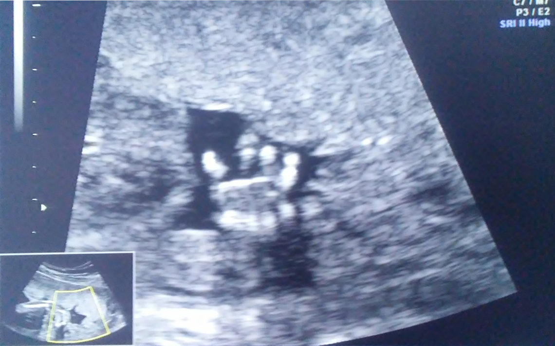 Pastors of Idaho Mercy Statement