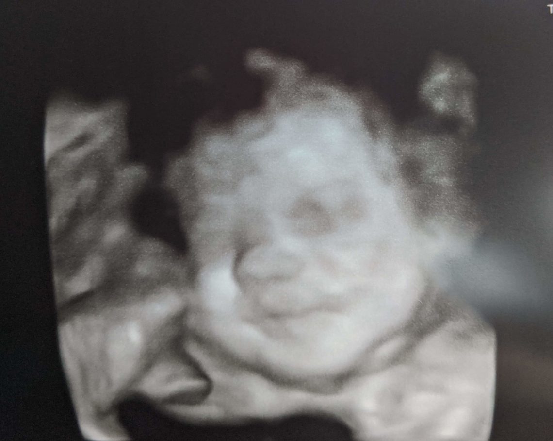 In Defense of Life – A Rebuttal